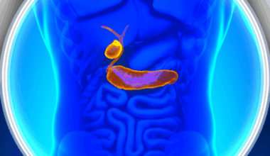 Pancreatic cancer recurrence plummets by targeting the Baltimore triangle- Oncology Central