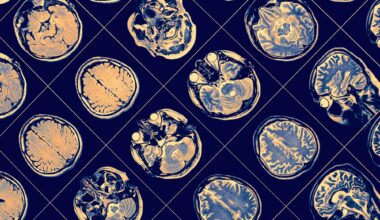 Study: Lymphoid gene expression supports neuroprotective microglia function. Image Credit: sfam_photo / Shutterstock