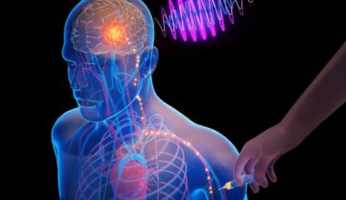 MIT researchers developing injectable chip for brain disorders