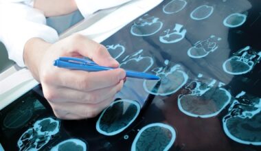 Nationwide mapping maps epilepsy incidence rates among older adults in the United States