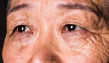 Your Vision Can Predict Dementia 12 Years Before a Diagnosis, Research Suggests : ScienceAlert