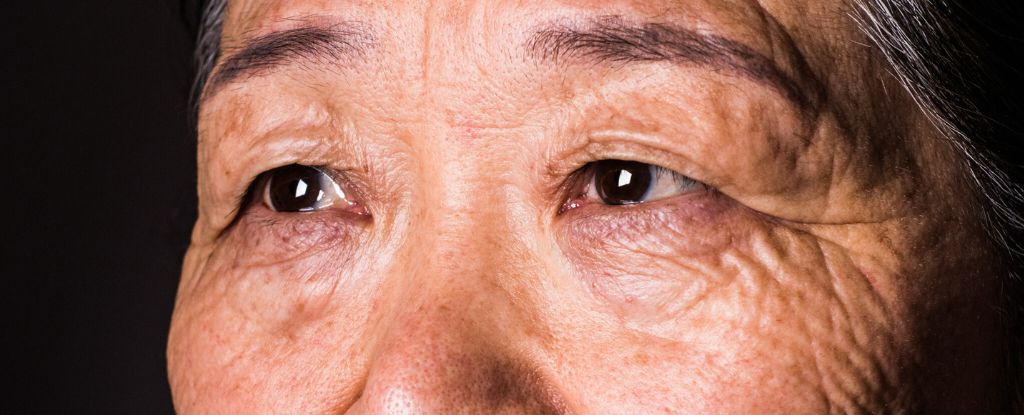 Your Vision Can Predict Dementia 12 Years Before a Diagnosis, Research Suggests : ScienceAlert