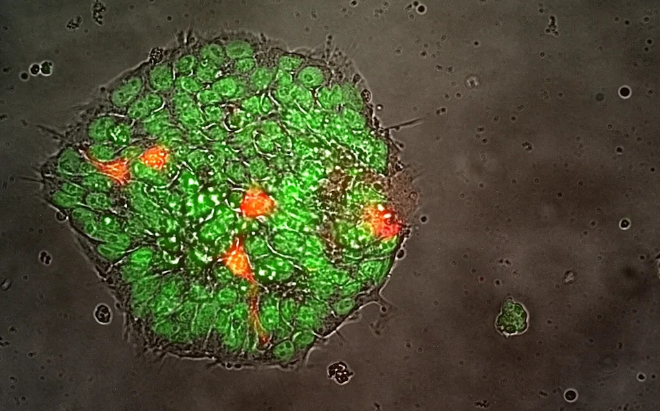 The scientists grow mini brains in space to see how they are affected