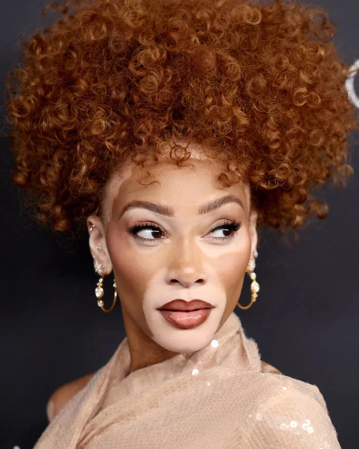 Winnie Harlow with curly hair looks to the side, wearing a sheer, textured top and gold hoop earrings at a celebrity event