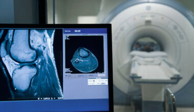 Stronger safeguards needed as AI healthcare grows in Europe, WHO warns - The Journal