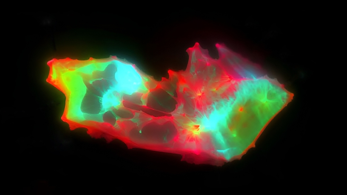 Strange Structures Found Lurking in The Blood of People With Long COVID : ScienceAlert