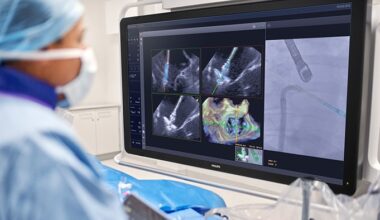 DeviceGuide in use with EchoNavigator -