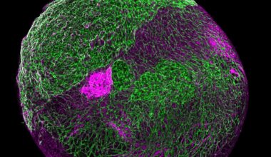 'Mini brain' research could benefit Alzheimer's studies