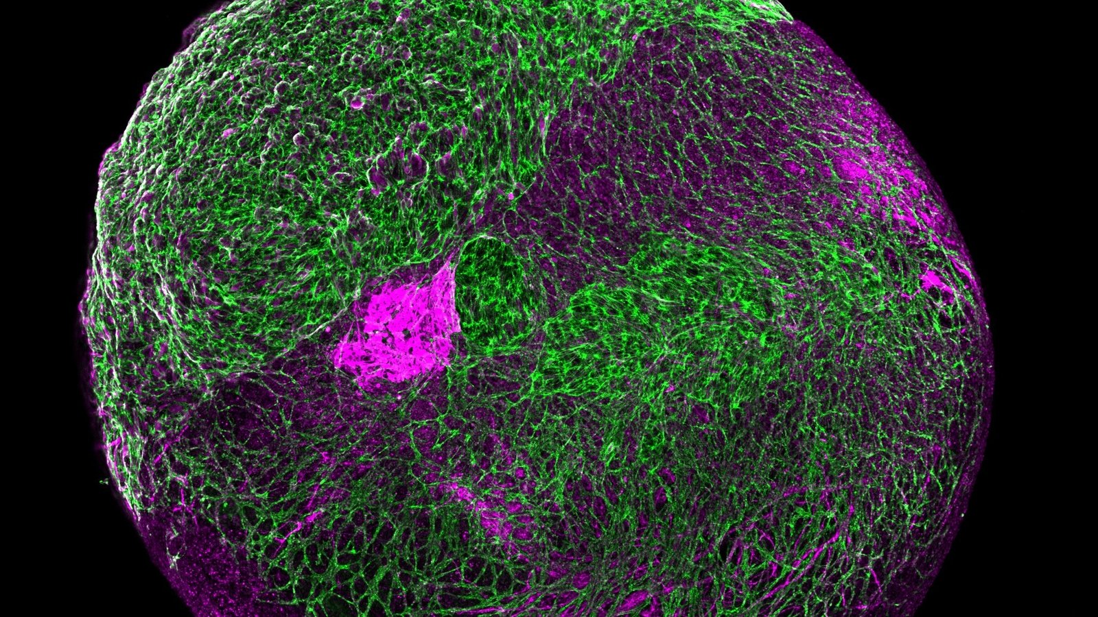 'Mini brain' research could benefit Alzheimer's studies