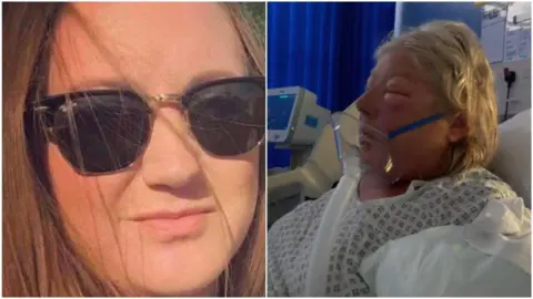 Wales News Service A composite picture. On the left the close-up of Danielle Oliver shows her with long brown hair, with strand in front of her face. She is wearing dark sunglasses. the right photo shows Belinda in a hospital bed. She has an oxygen mask on, and is wearing a hospital gown. Her right eye is so swollen it's shut and her left eye is also badly swollen. 