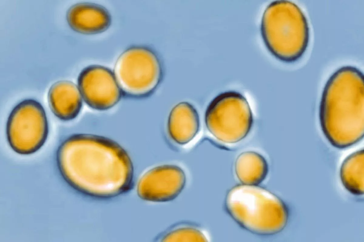 Candida auris is a yeast responsible for many infections. Resistant to most antifungal drugs, this fungus causes several deaths worldwide. Optical microscope view. (Photo by: BSIP/Education Images/Universal Images Group via Getty Images)
