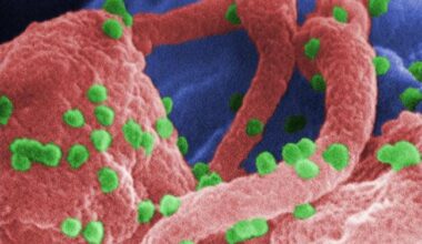 Scanning electron micrograph shows HIV as tiny green spheres scattered atop the surface of a lymphocyte cell.