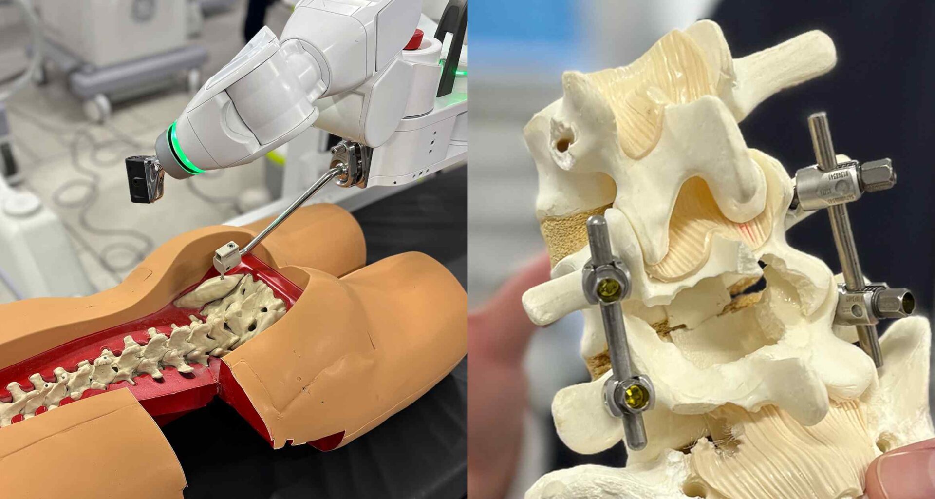 Japan faces calls for higher medical device reimbursement amid cheap yen