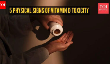 Vitamin d toxicity symptoms: 5 physical signs of vitamin D toxicity you should know |