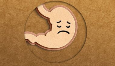 Stay Well: What is indigestion and how can I manage it or avoid it?