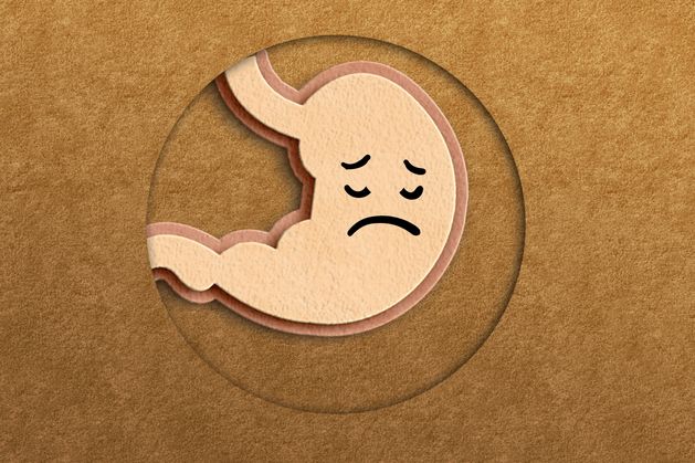 Stay Well: What is indigestion and how can I manage it or avoid it?
