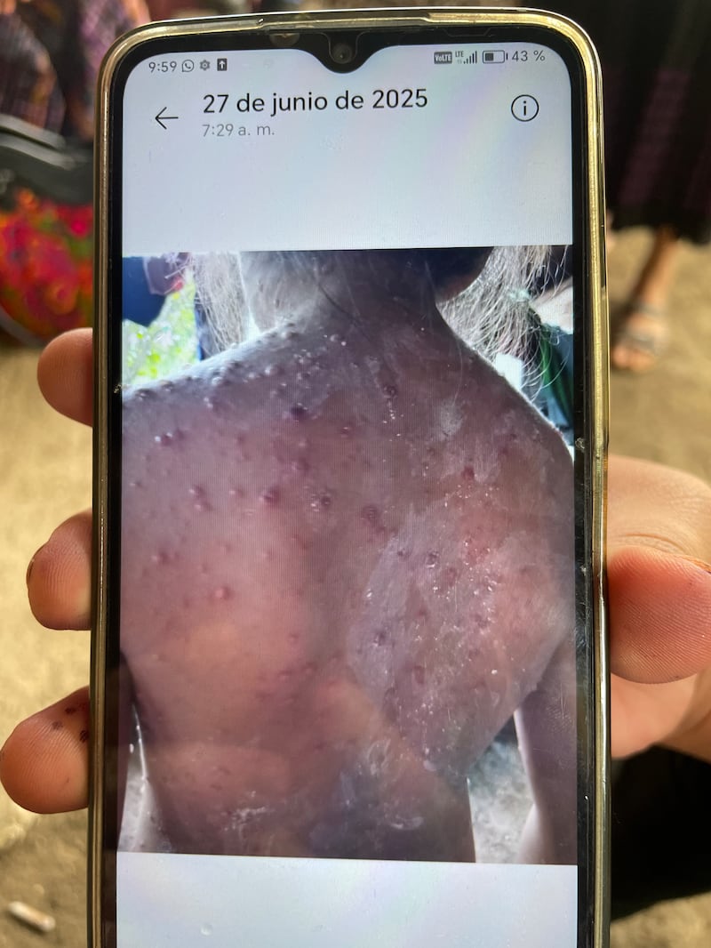 Residents say pests and skin diseases are now common. Photograph: Hannah McCarthy