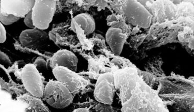 Volcanic eruptions brought Black Death to Europe and killed up to 50 million, new study finds