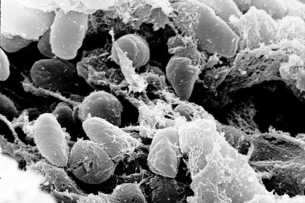 Volcanic eruptions brought Black Death to Europe and killed up to 50 million, new study finds