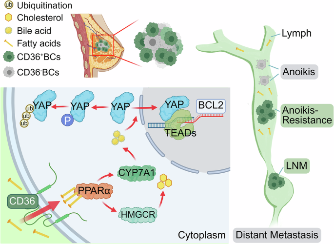 Elevated CD36 drives lymph node metastasis of breast cancer by activating Hippo-YAP signaling-mediated anoikis resistance