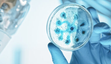 Strengthening Europe’s response to infectious disease threats | ISIDORe Project | Results in Brief | HORIZON | CORDIS