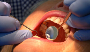 Push on for more dental training places in Cork