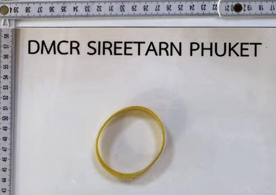 Similan sea turtle rescued after swallowing tourist's wristband