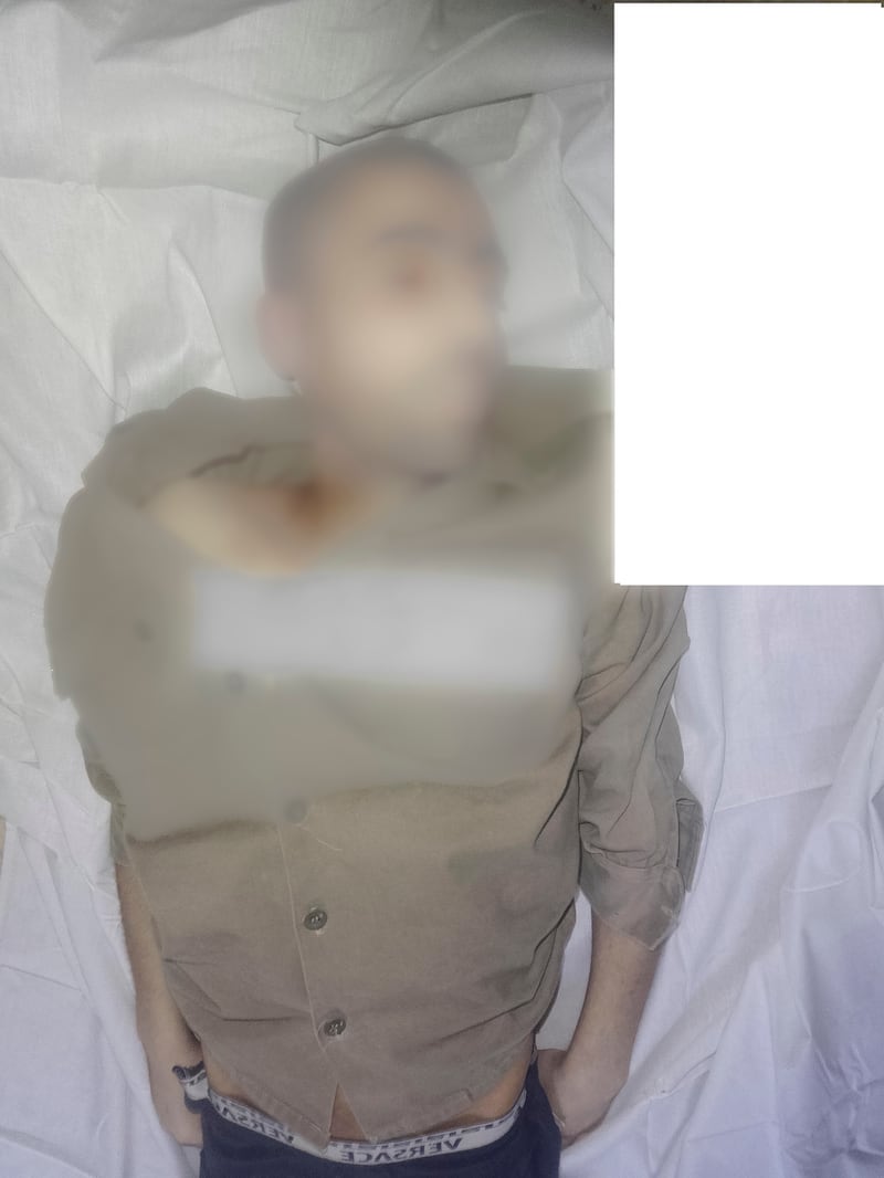 A blurred image of the body of Abdullah Hussein Al-Akhras. This picture has been published with the consent of his family.