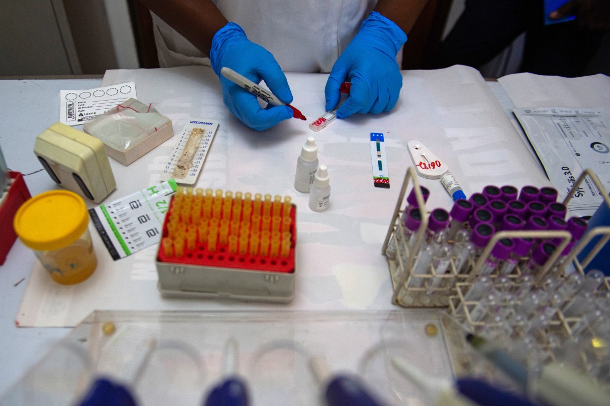 HIV killed 559 Nepalis and infected 614 last year