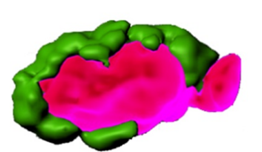 Alzheimer’s, Parkinson's, and Cancer