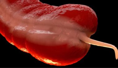 A Rare Cancer Is Surging in Young People, And Experts Are Puzzled : ScienceAlert