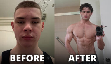 Teen’s extreme ‘self-improvement’ tactics shock internet