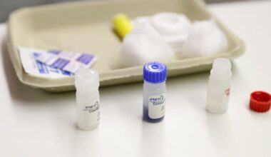 Continued rise in HIV diagnoses after drop during pandemic – The Irish Times