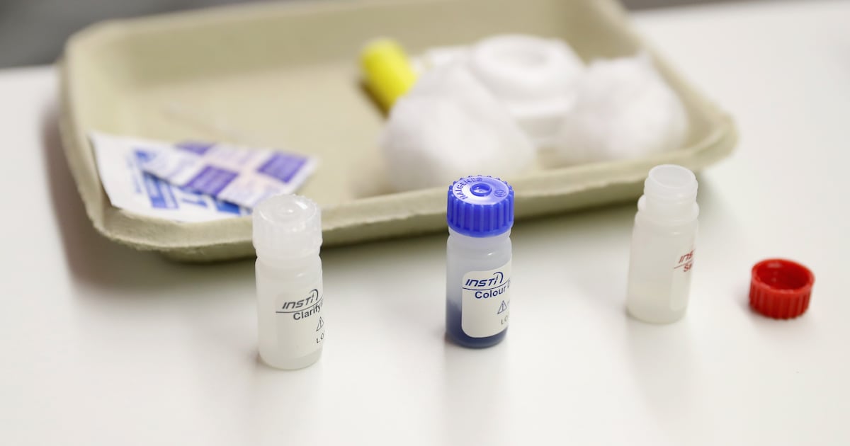 Continued rise in HIV diagnoses after drop during pandemic – The Irish Times