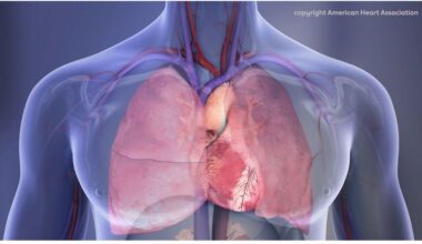 ACC/AHA issue new guideline on managing congenital heart disease in adults