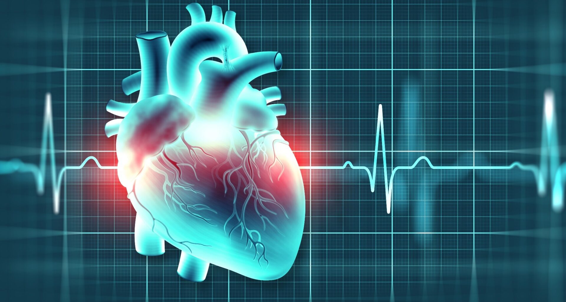 Study: Diabetes and sudden cardiac death: a Danish nationwide study. Image Credit: Yurchanka Siarhei / Shutterstock