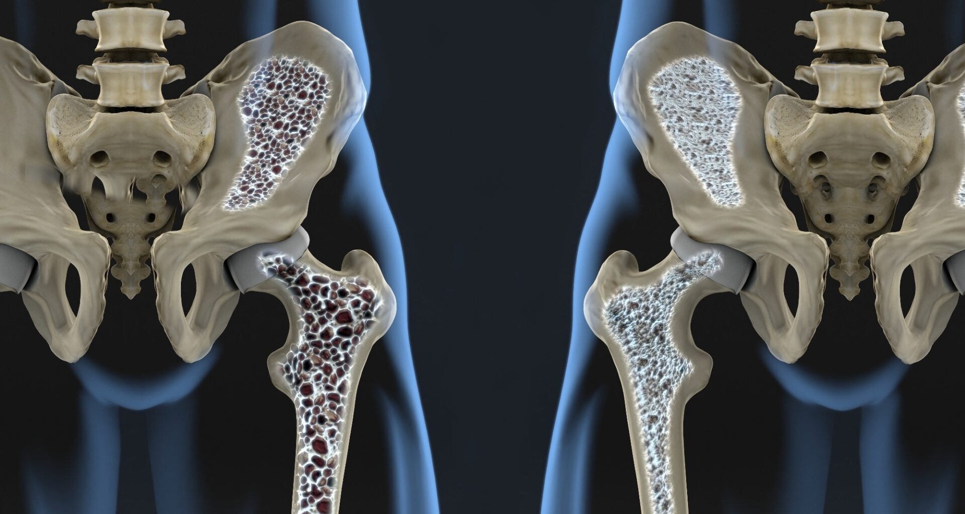 Study: The relationship between serum total alkaline phosphatase and risk of osteoporosis: a cross-sectional study. Image Credit: Javier Regueiro / Shutterstock
