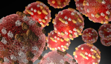 Auckland measles outbreak: One new case and two new exposure sites