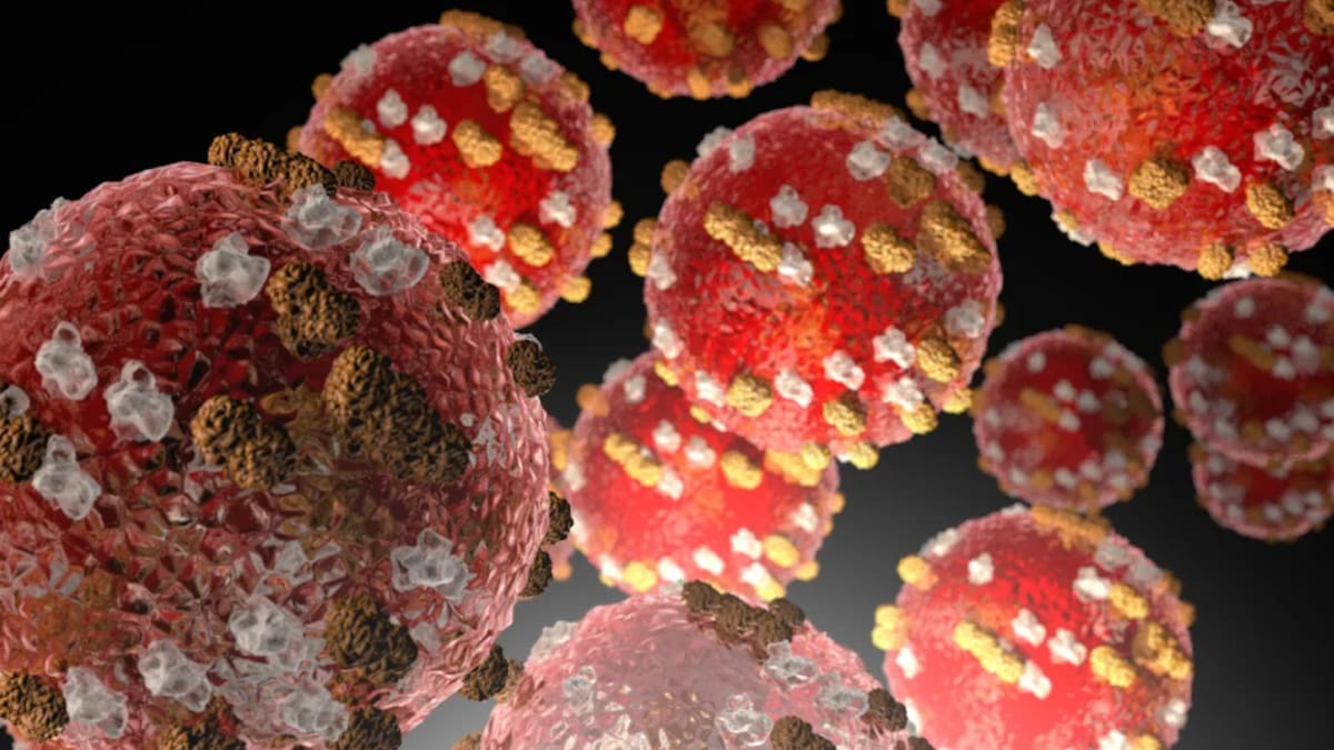 Auckland measles outbreak: One new case and two new exposure sites