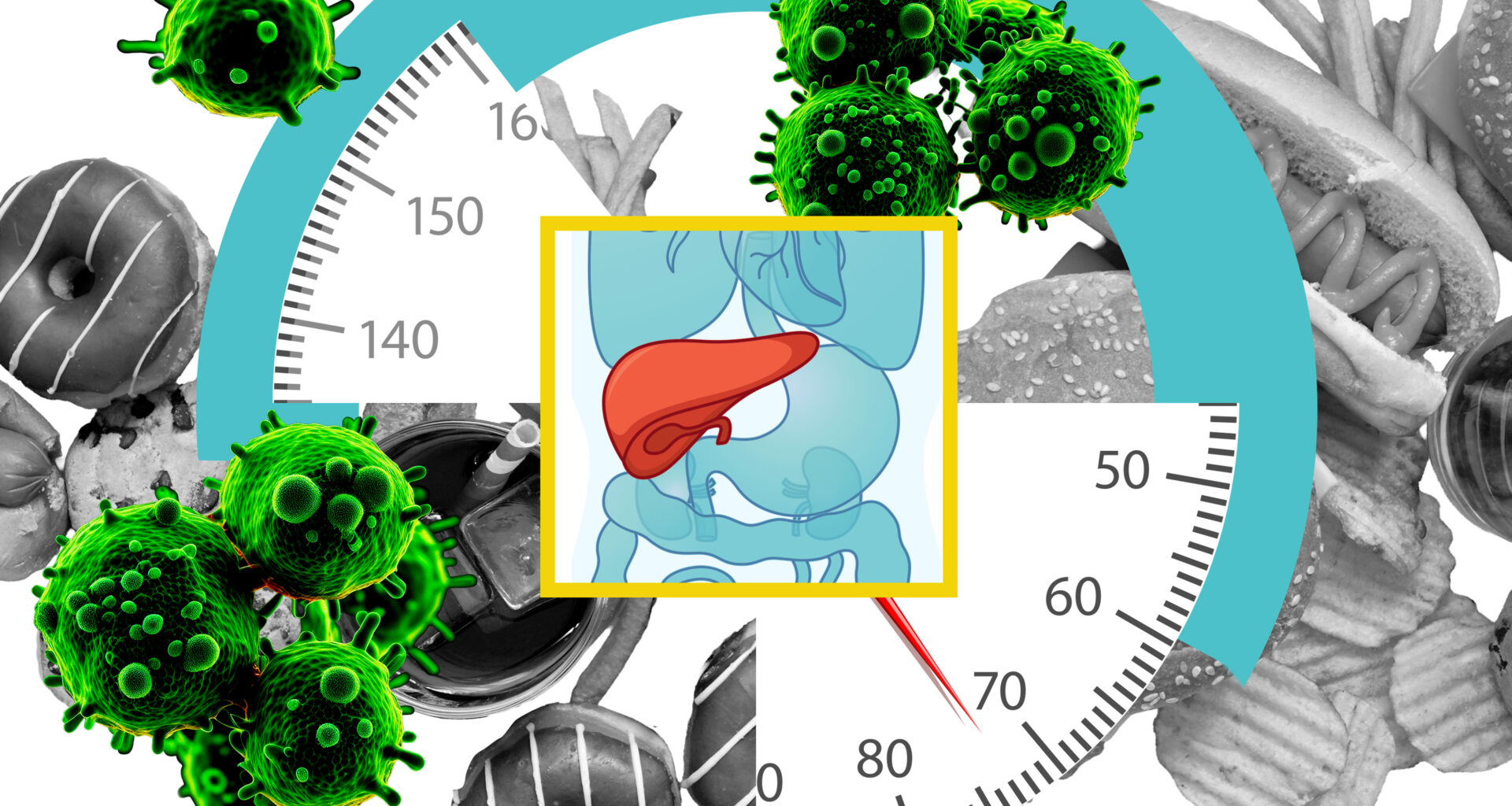 Study: High-fat diets make liver cells more likely to become cancerous | MIT News