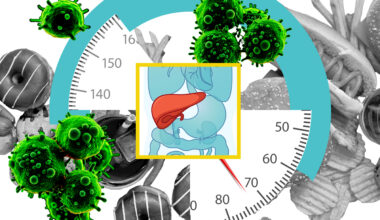 Study: High-fat diets make liver cells more likely to become cancerous | MIT News
