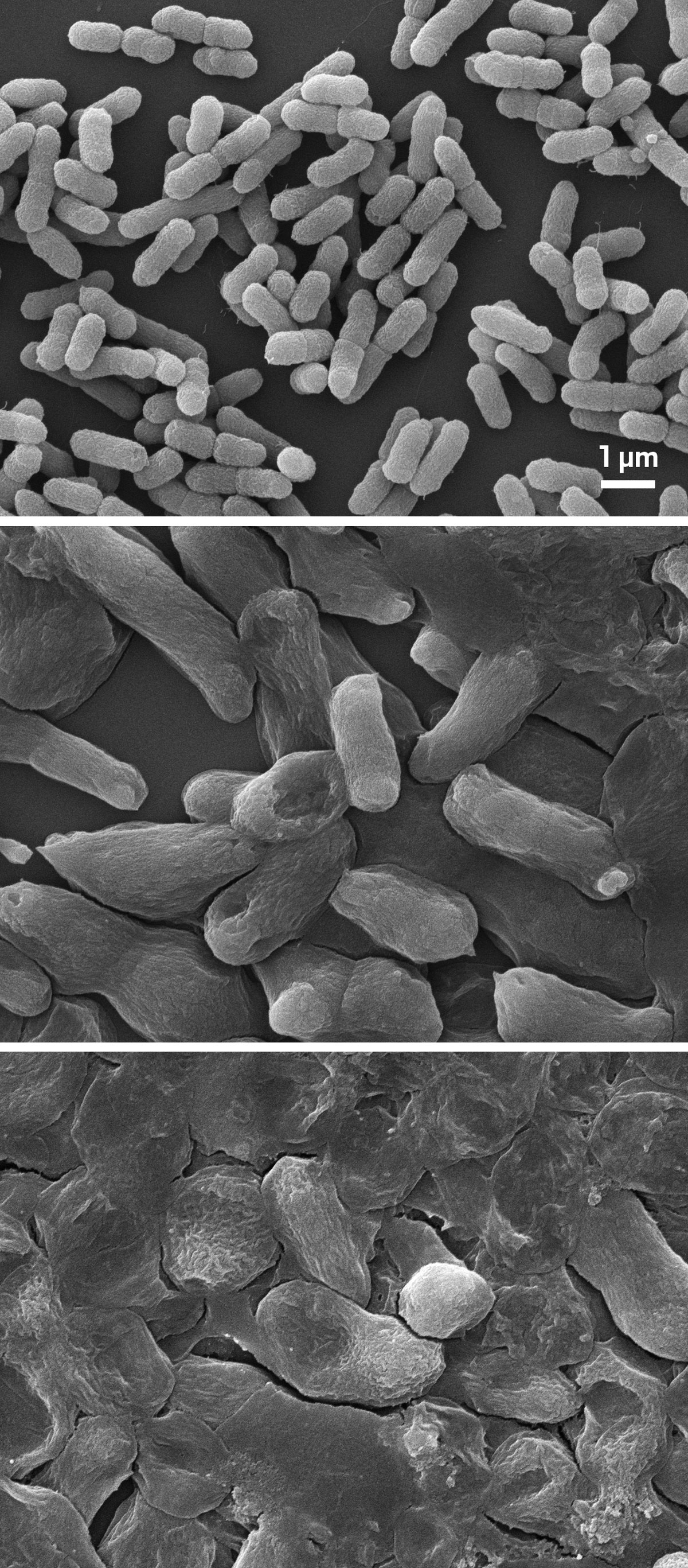 Scanning electron microscope images showing untreated, drug-resistant bacteria (top) and after being exposed to normal (middle) and high doses (bottom) of the vancomycin derivative. There is noticeable cellular damage with the higher dose.