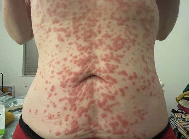 Juliette Burton ATT: Hannah Shewan Stevens - Misogynistic medical gaslighting Picture: Juliette Burton