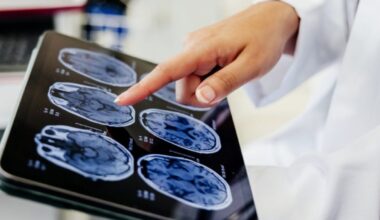 Depression, anxiety and PTSD have same genetic roots – what it means for treatment