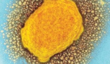 AI helps researchers to find a new way to fight the monkeypox virus