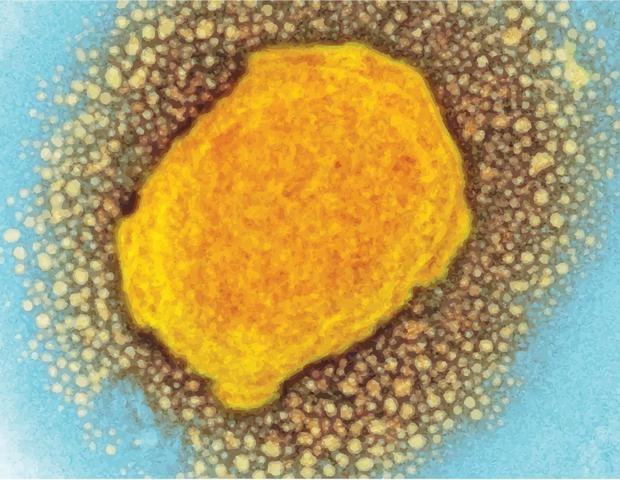 AI helps researchers to find a new way to fight the monkeypox virus
