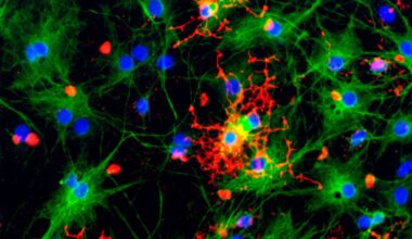 Prion-Like Brain Damage Can Occur Without Infectious Prions, Study Finds : ScienceAlert