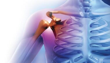 Science Proves the Benefits of a Traditional Brazilian Plant for Treating Arthritis