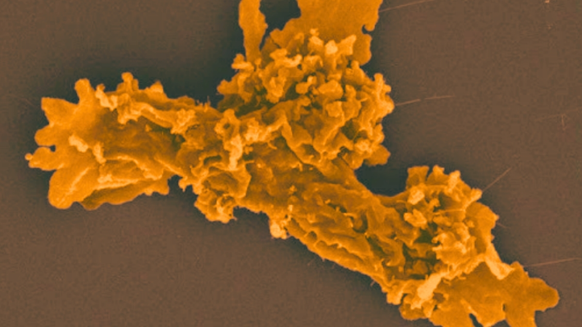 Extreme 'Fire Amoeba' Smashes Record For Heat Tolerance : ScienceAlert