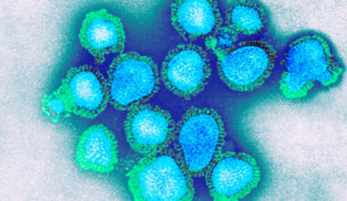 Here are the hospitals that have introduced visitor restrictions due to high flu cases